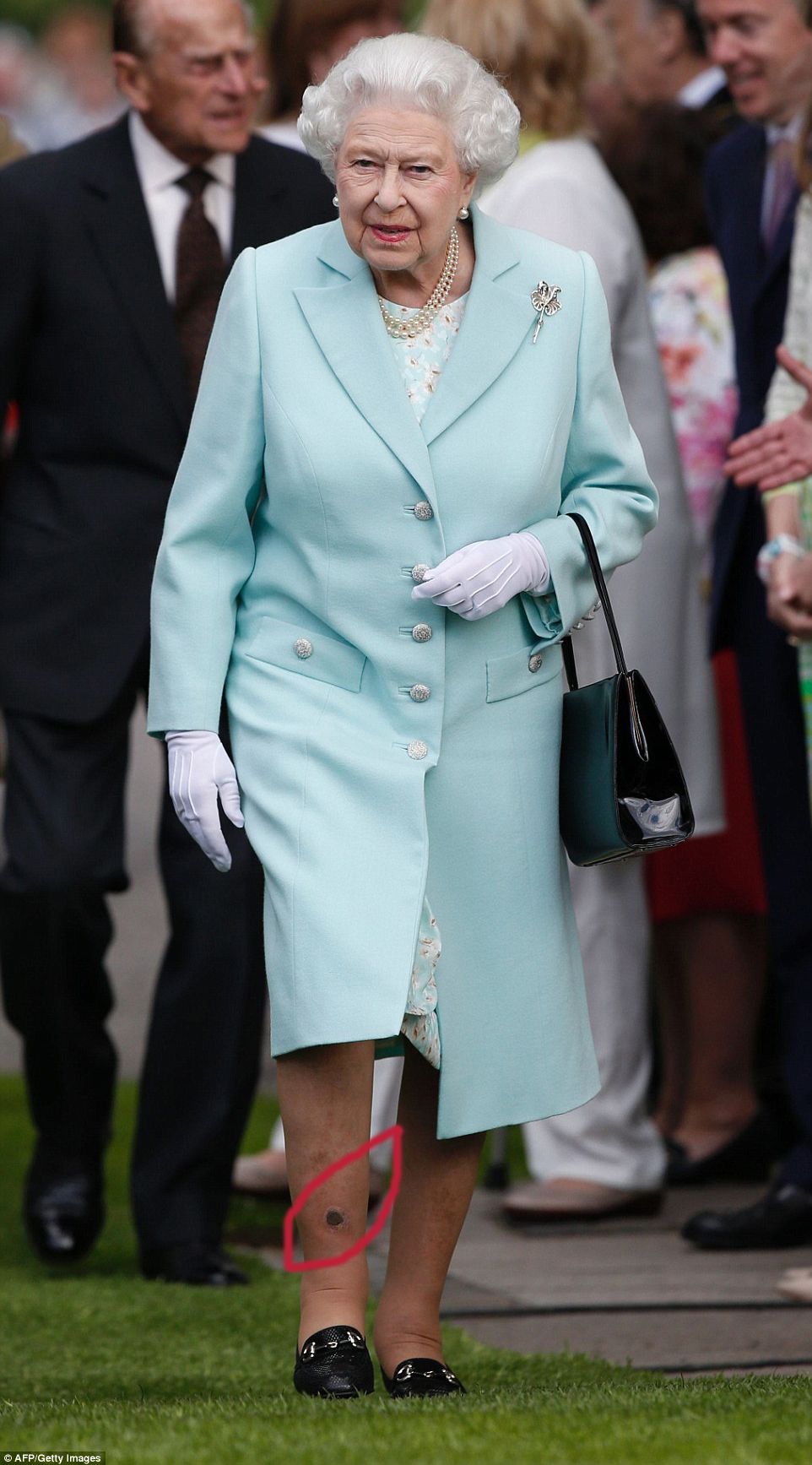 الملكة اليزابيث والحفرة السوداء في أسفل ساقها أمام كل المصورين الذين غطوا معرض الزهور في بريطانيا