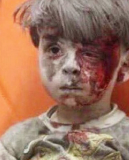 الطفل السوري عمران