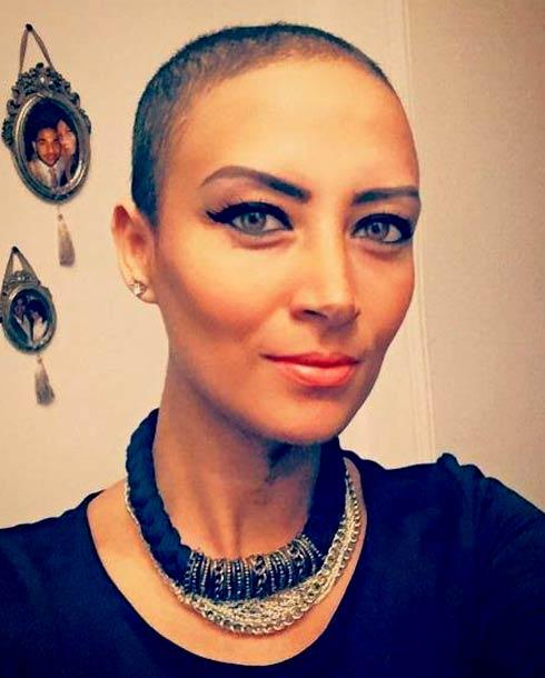 الممثلة المصرية ياسمين غيث أصيب بمرض سرطان الثدي