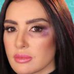 ميساء مغربي: تعرضت للضرب والتعذيب من زوجي - فيديو