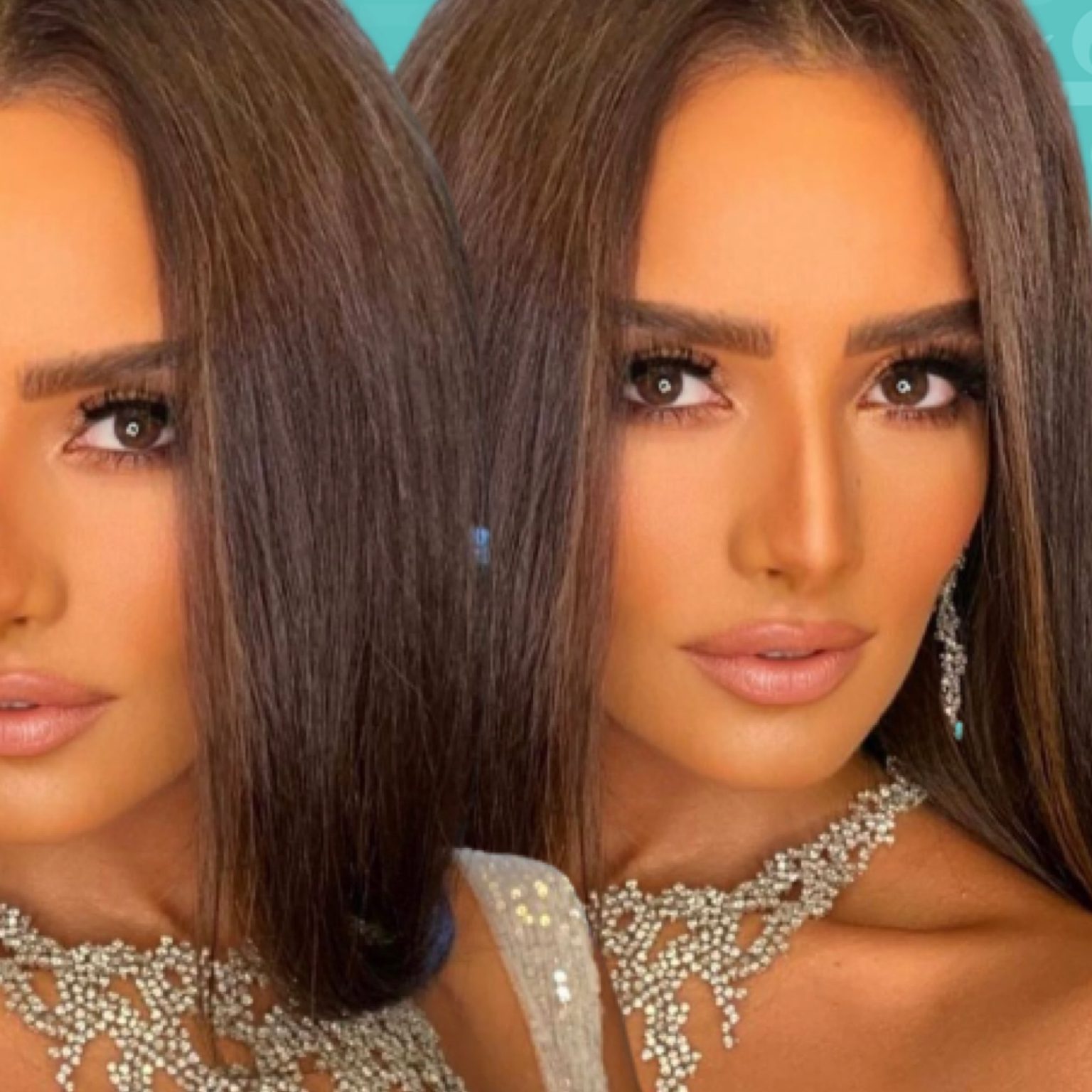 زينة تخضع لعملية بعد ١٢ عامًا - فيديو