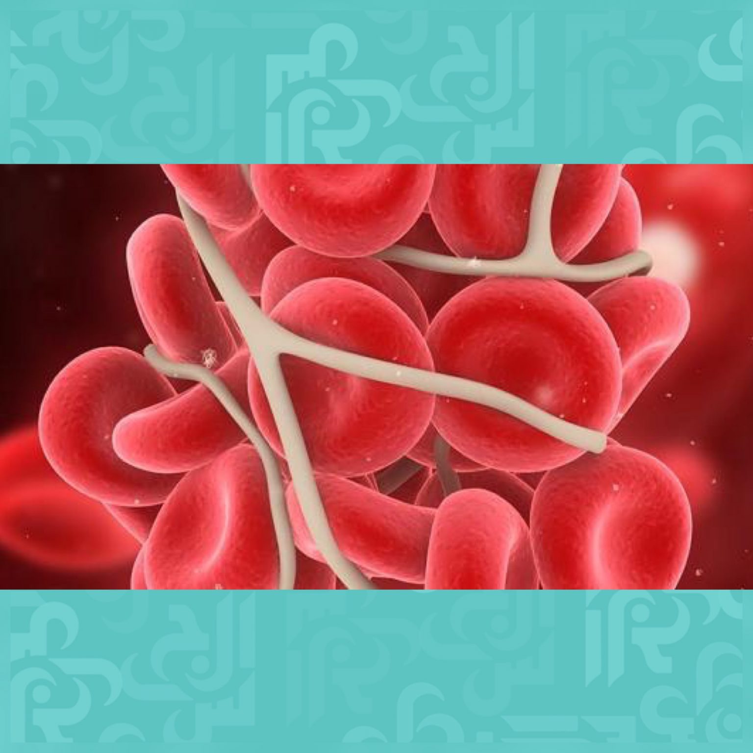 ابيضاض الدم أسبابه وأنواعه ابيضاض الدم أسبابه وأنواعه