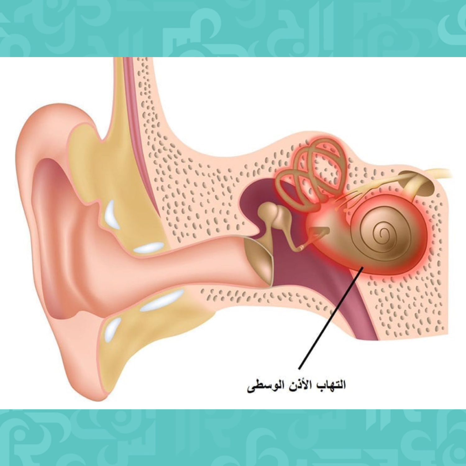 Болезнь внутреннего уха. Тубоотит барабанная перепонка. Аллергический тубоотит.