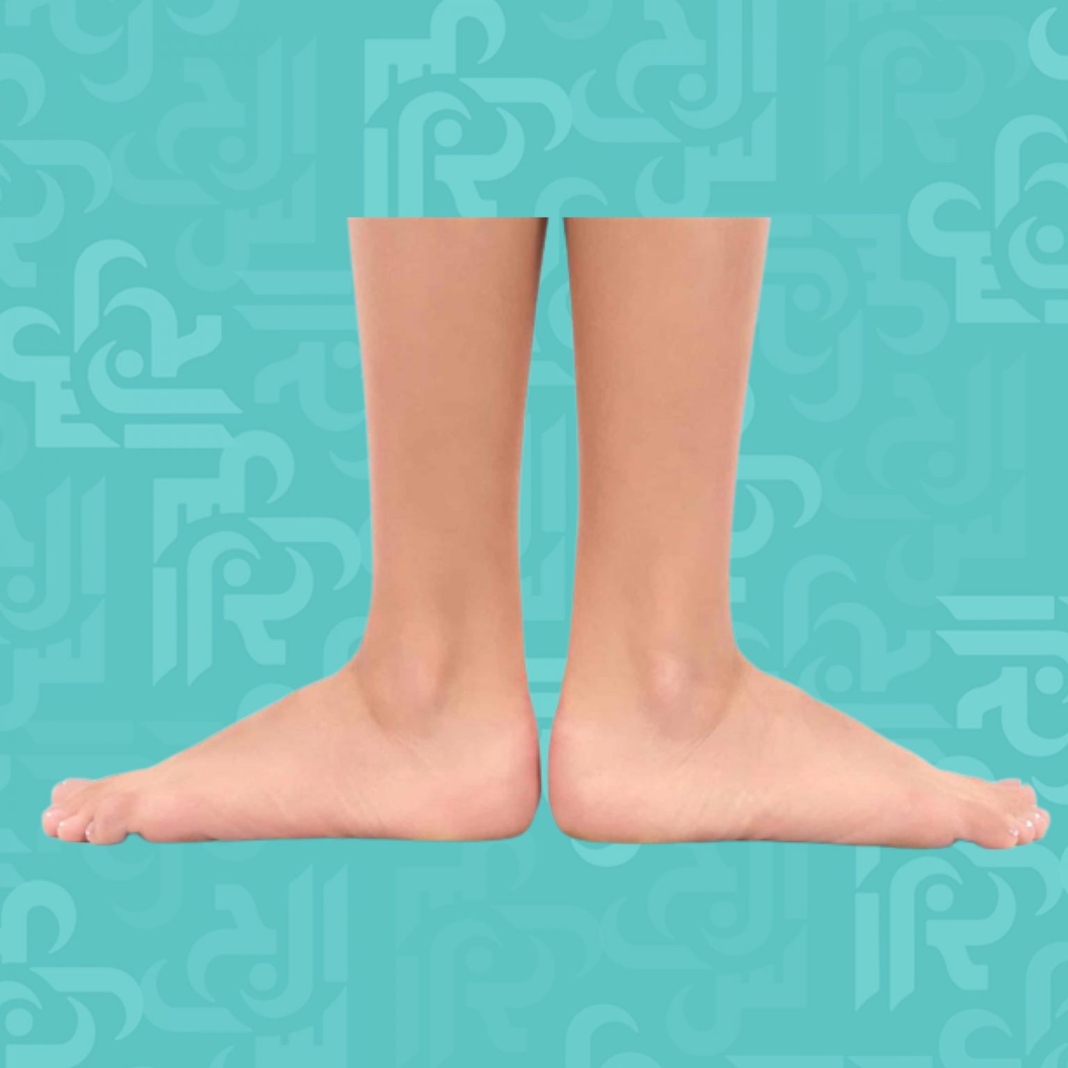 اسباب واعراض الاقدام المسطحة