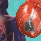 هل يشفى مريض ضعف عضلة القلب؟
