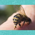 طبيب سوري يعالج مرضاه بلسعات النحل!