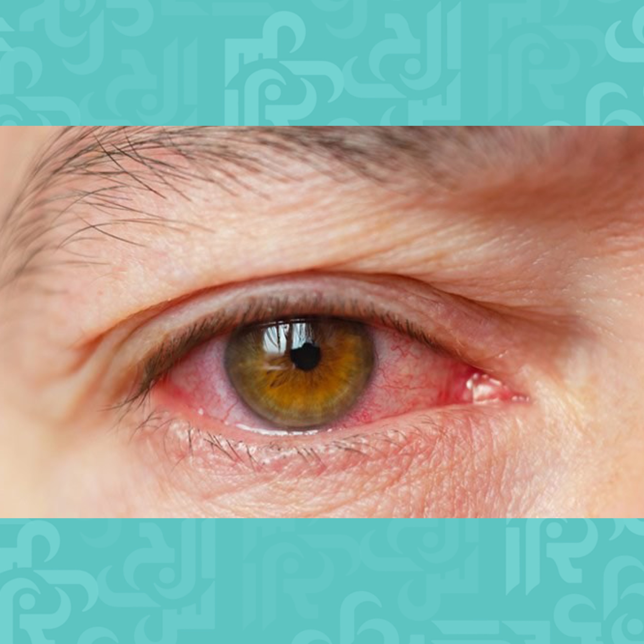 أضرار جفاف العين – دراسة | مجلة الجرس