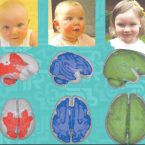 صحة دماغ الأطفال مرتبطة بساعات النوم