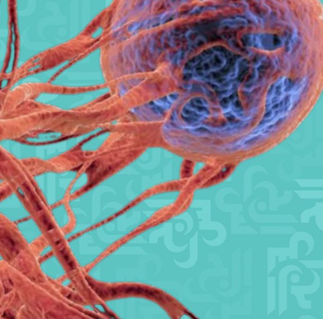 5 أنواع من السرطان الأكثر انتشارًا في لبنان