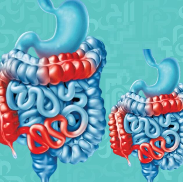 كيف يؤثر داء الأمعاء الالتهابي على الجسم - دراسة